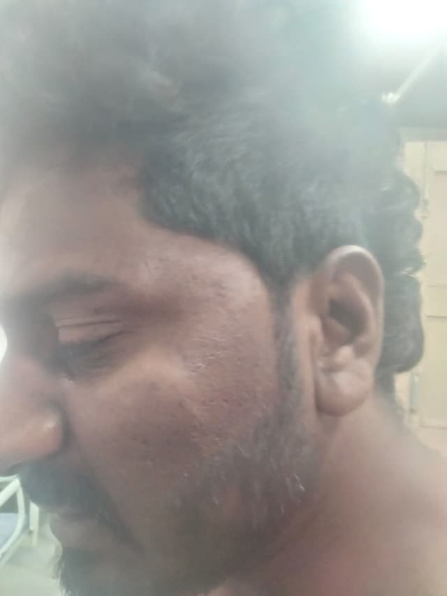 ಬಸಾಪಟ್ಟಣ ಹಿಂದು ಯುವಕನಿಗೆ ಗಂಗಾವತಿ ಮುಸ್ಲಿಂ ಯುವಕರಿಂದ ಹಲ್ಲೆ- ಯುವಕನ ಬಗ್ಗೆ ಅಪಾರ್ಥ: ಮನಸ್ಸೋ ಇಚ್ಛೆ ತಳಿತ- ಮಾರಣಾಂತಿಕ ಹಲ್ಲೆ:ನಾಲ್ವರು ಆರೋಪಿಗಳ ಬಂಧನ